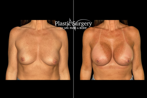 Click here for more before and after photos.