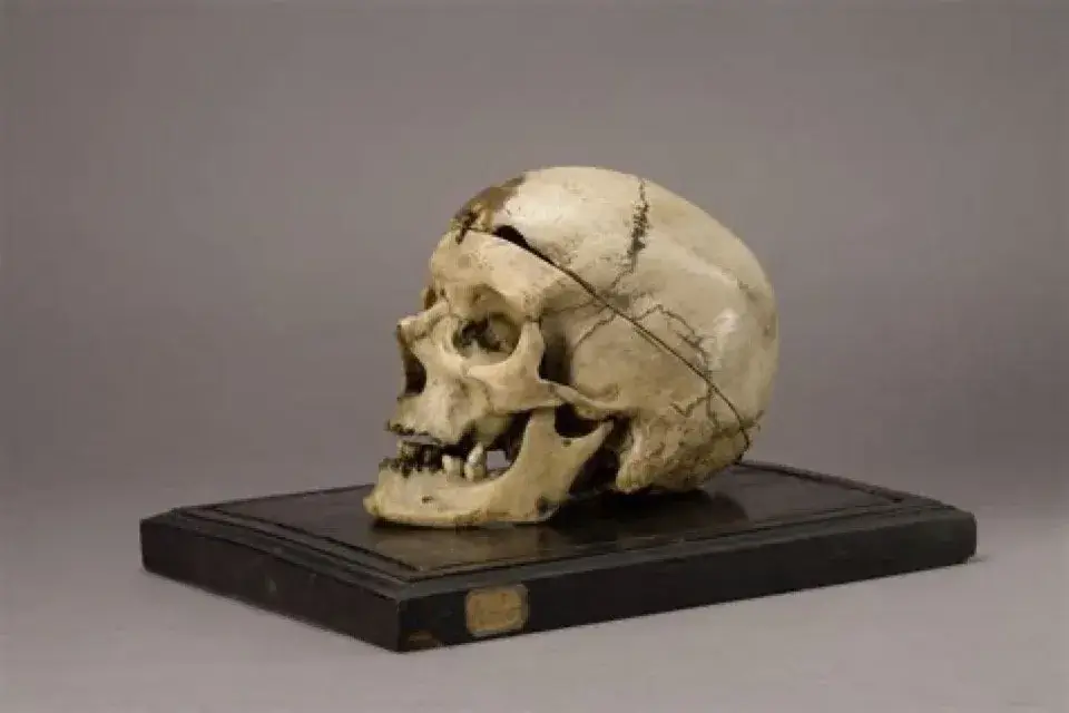 Il cranio del brigante Vilella