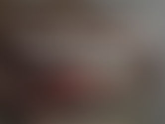 Lacerations: Home Care vs Emergency