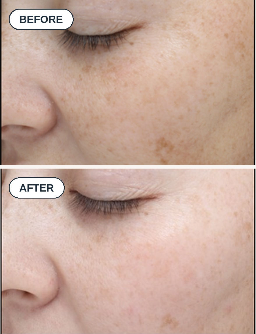 peel-before-after-stacked.jpg