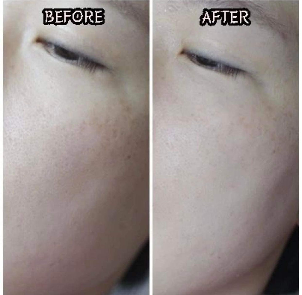 Thumbnail: ID.AZ FACE FIT PLASTER MASK