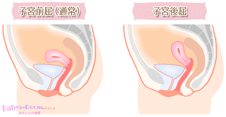 子宮 後 屈 妊娠 お腹 の 出 方