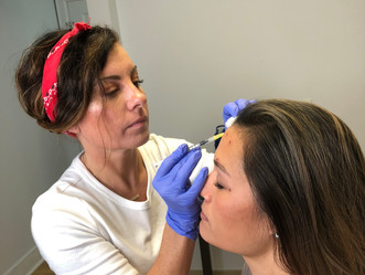 Botox Rochester NY