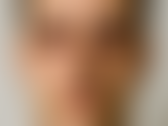 החלמה מניתוח פטוזיס