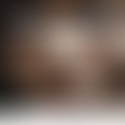 ADUR-RJ e SINTUR contra o racismo