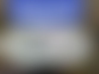 【野球選手に多い有鉤骨骨折】手の痛みを放置しないで!