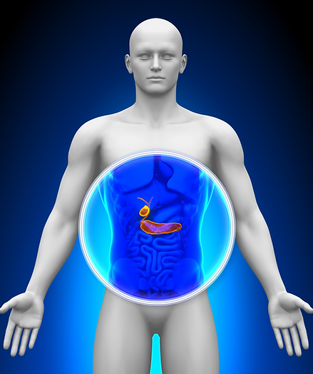 piedras en la vesicula veracruz.png