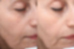 Miniaturbild: Artmed RenPico Smart CXS