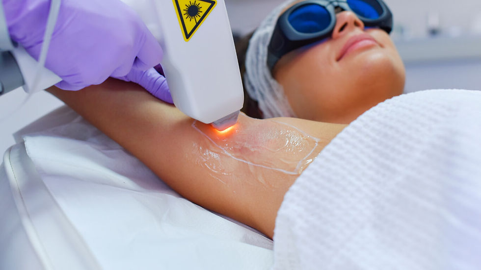 Diode Laser: Best Choice for Permanent Hair Removal
