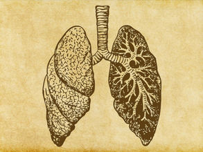 Tumores de mediastino