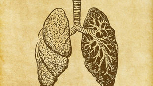 What is Interstitial Lung Disease?
