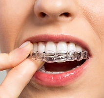 Ortho7gouttieretranslucide.jpg