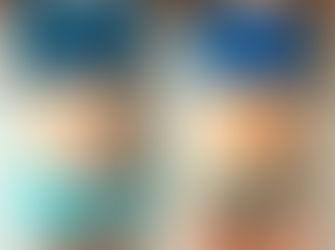 Liposuction Ameliyatı Sonrası Oluşabilecek Cilt Sarkmasını Nasıl Önleyebiliriz?