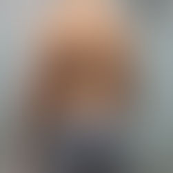 Bel bölgesinde yağlanma fazlası olan klasik  erkek vücut şekli. Bu kısımda ki yağlar zayıflamaya çoğunlukla dirençlidir. Bu yüzden liposuction uygulanması son derece etkili olmaktadır.
