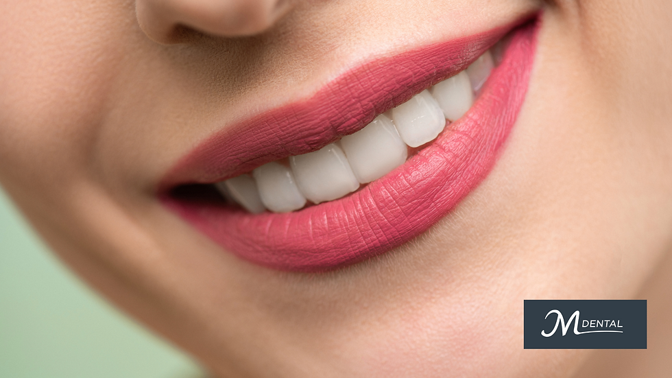 Full Mouth Rehabilitation