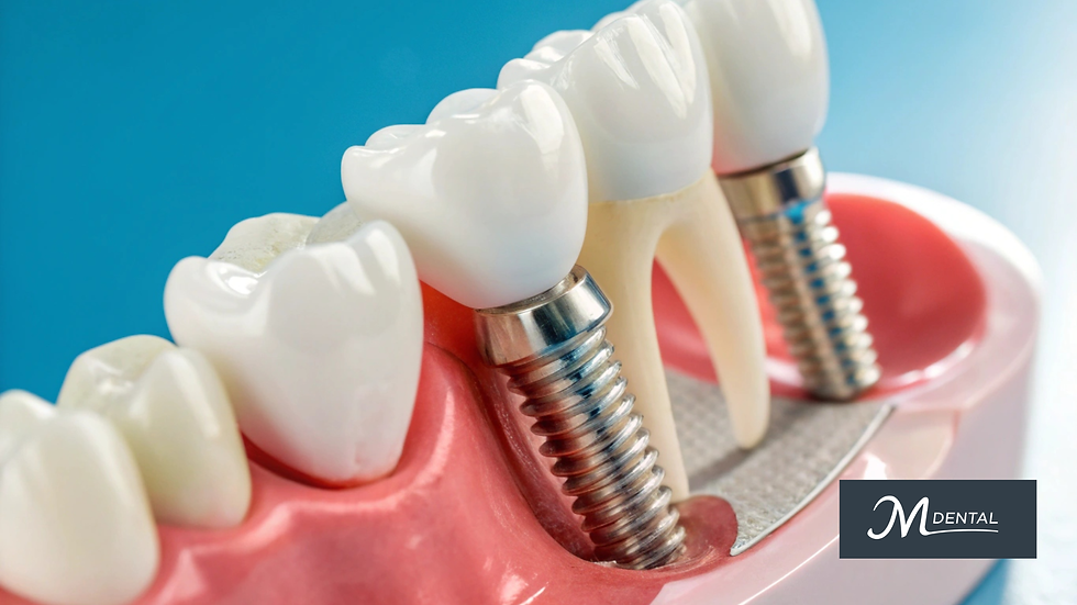 Single Tooth Implant vs Dental Bridge: The Real Pros, Cons & Costs Explained by a Dentist