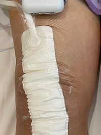 A PICO knee dressing that is clean.