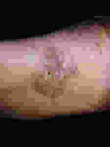 Före