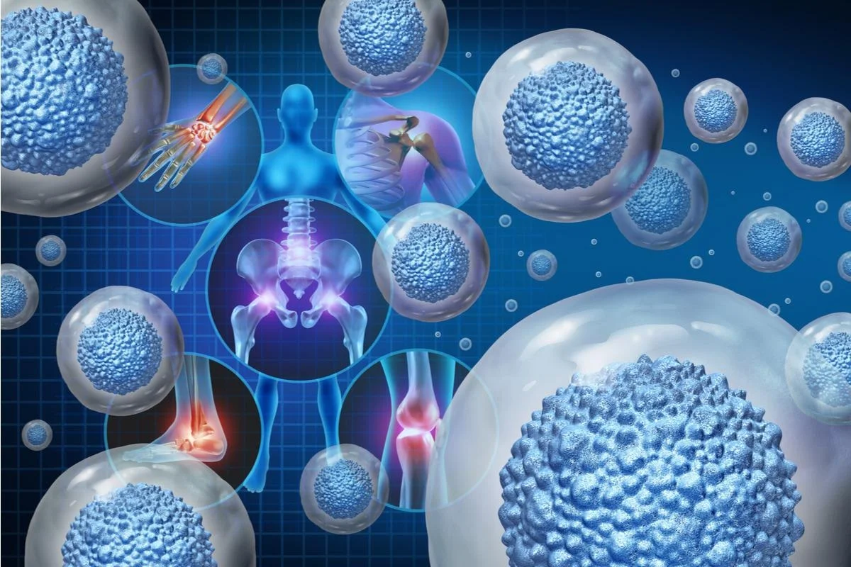 Orthobiologics.webp
