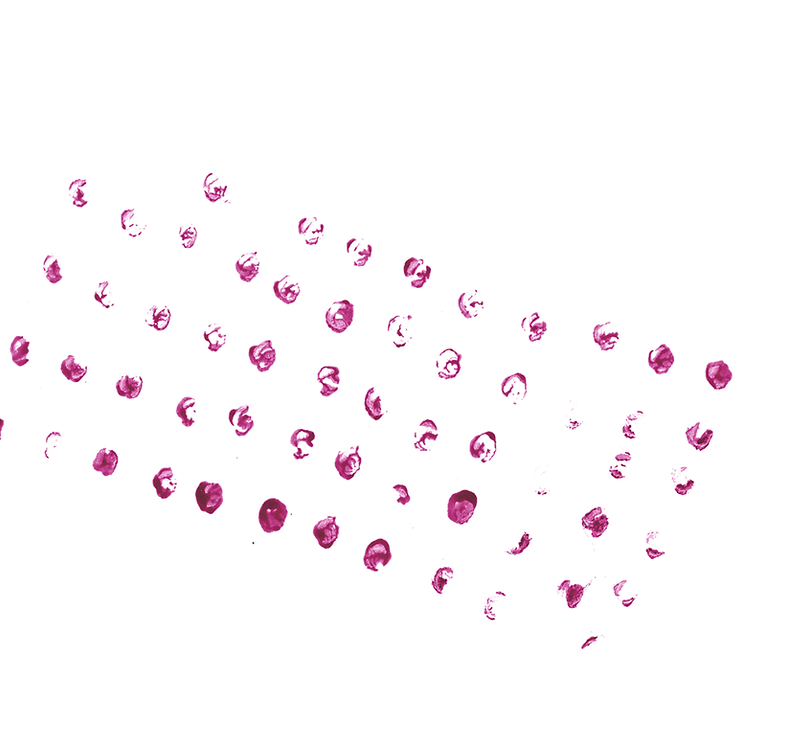 DOTS%20_edited.png