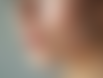 Discover the Skin Rejuvenation Benefits You’ll Love