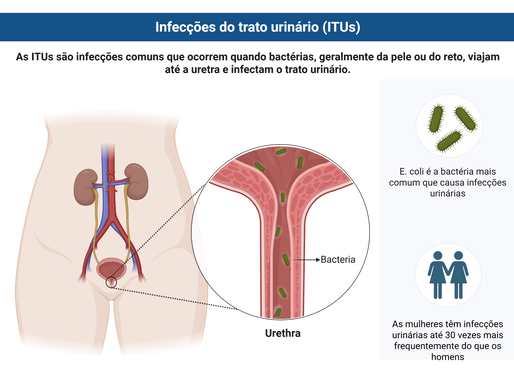 Infecção vaginal e nutrição