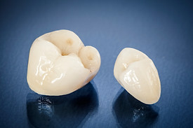 Pressed Ceramic.jpg