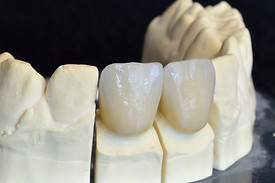 Zirconia2.jpg