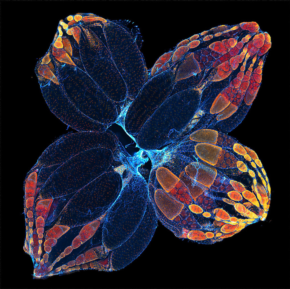 Ovaries of a fruit fly photographed through a microscope