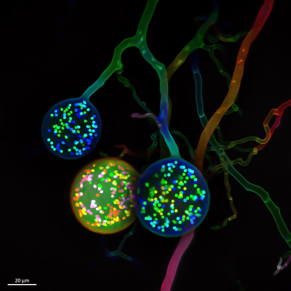 Spores of soil fungus photographed through a microscope