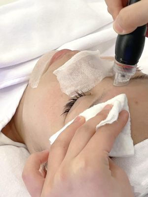 Affordable Facial Treatments