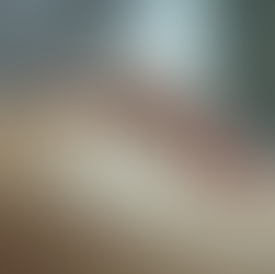 Understanding Acupuncture Its Benefits and How It Works