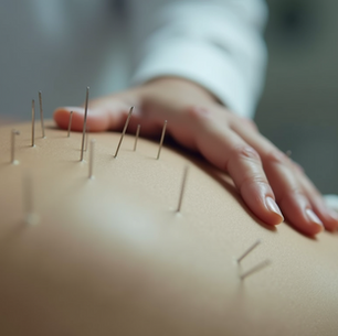 Understanding Acupuncture Its Benefits and How It Works
