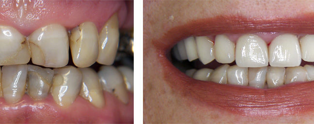 WHY SHOULD YOU CHOOSE DENTAL TOURISM?