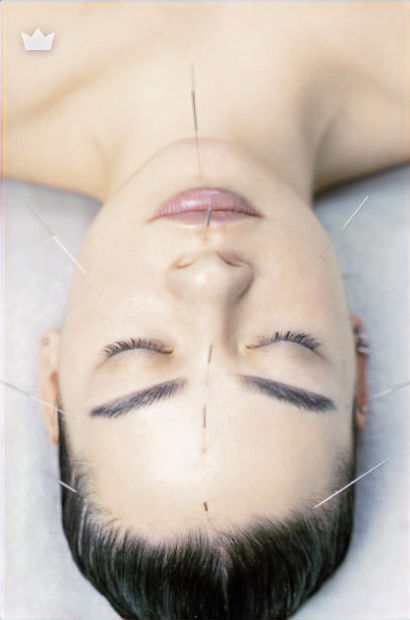 Chinese Acupuncture Clinic