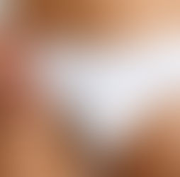 Harmonização Íntima Masculina: confiança, naturalidade e bem-estar