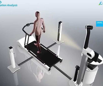 DIERS 4D motion ||| HIGH PERFORMANCE  ﻿﻿High performance version with up to 240 fps  ﻿﻿Dynamic / functional measurement of the spine/vertebral bodies and  DIERS leg axis  |I HIGH PERFORMANCE  ﻿﻿High performance version with up to 240 fps  ﻿﻿Video motion capture for detection of gait pattern and leg  DIERS pedogait  /II HIGH PERFORMANCE  ﻿﻿Treadmill with instrumented pressure plate  ﻿﻿High performance version with up to 240 fps  ﻿﻿Speed up to 30 km/h (18.4 mph)  ﻿﻿Uphill up to 25% / Downhill up to