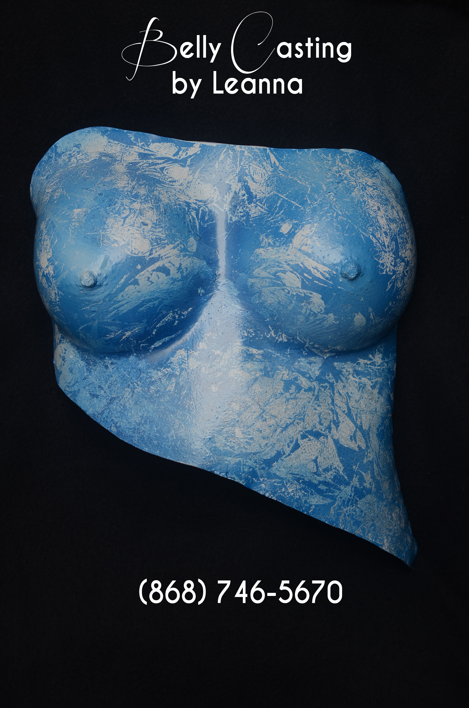 Breast Cast