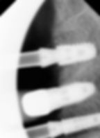 IS20180710_122517_0522_00000091