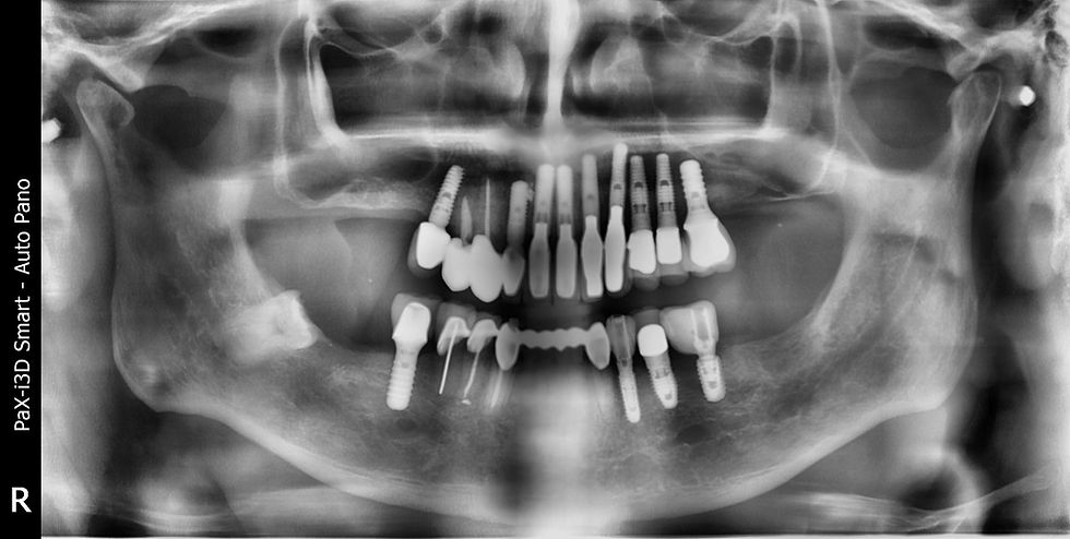 PX20181126_105712_0000_00000EE2