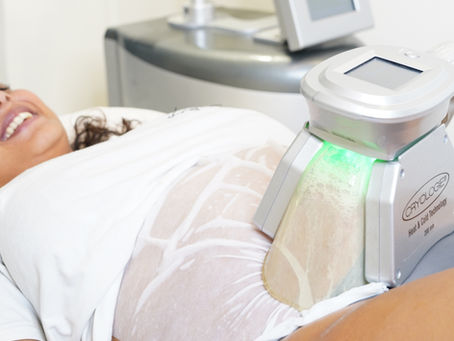 Cryolipolyse à Marseille : La Solution Non-Invasive Pour Éliminer les Graisses Localisées