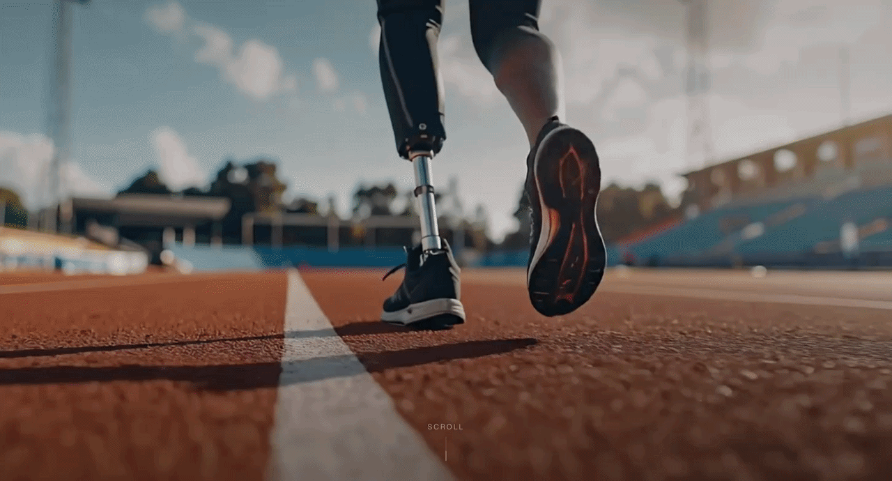Prostheses-2.gif