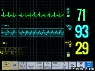 7Q0T.gif