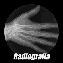 radiografia-rayo-x.gif