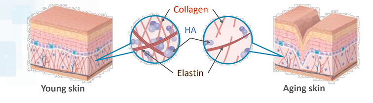 Illustration of young and aging skin differences