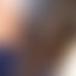 酸性ストレートや縮毛矯正の失敗による深刻なダメージ毛(ビビリ毛)と、美容室サンローズでのリカバリー施術事例。