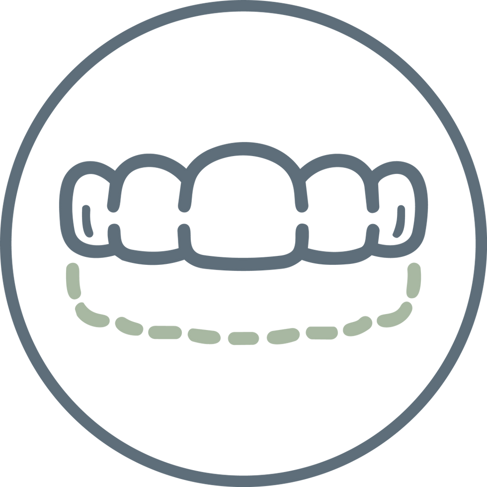 ZRM Aligner-Therapie.png