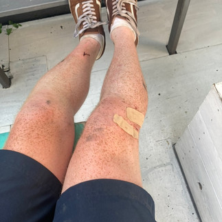 muddies and bloodied legs