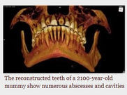 Forensic Dentistry In Miriam's Time