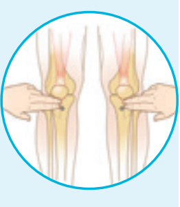 Source: https://www.teleflex.com/usa/en/clinical-resources/ez-io/index